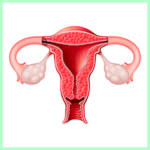 Ovarian cysts