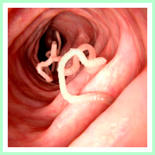 Parasitic Infections