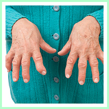 Rheumatoid arthritis