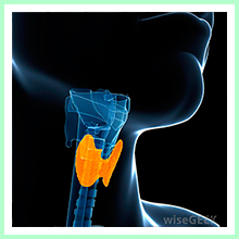 Thyroid dysfunction - Hypothyroidism