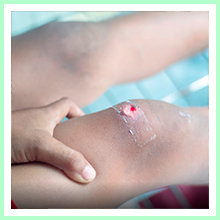 Trophic ulcer Trophic ulcer