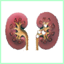 urolithiasis disease3
